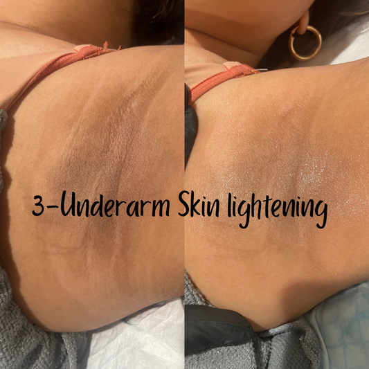 3 Underarm Lightening sessions